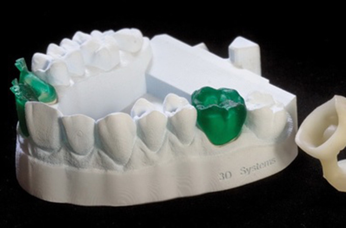 德國率先引入3D打印牙齒技術 全程體驗“無痛”種牙-e鍵打印|3D打印服務
3d打印牙齒,3D打印種牙,無痛種牙,3D打印平臺,3D打印服務,南京哪里有3D打印,南京3D打印廠家,南京3D打印服務