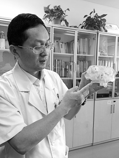 醫療3d打印應用實例 3D打印精準“再造”上頜骨