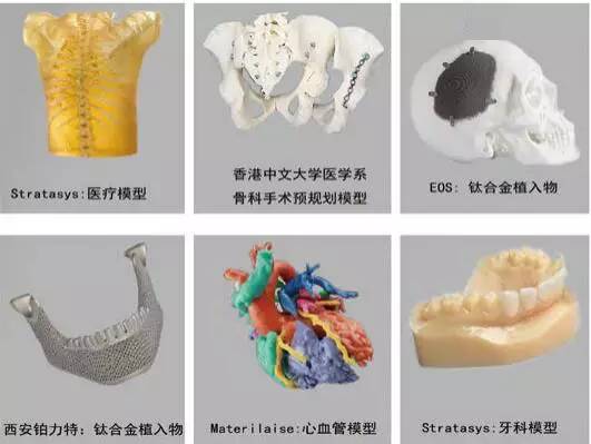 3d打印在醫療領域的應用 3D打印與醫療行業白皮書