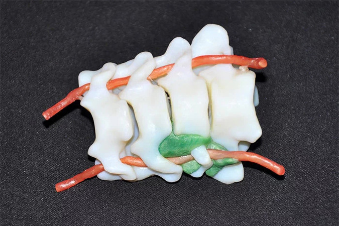 全彩3D打印頸椎骨科模型